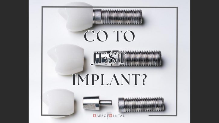 Co to jest implant