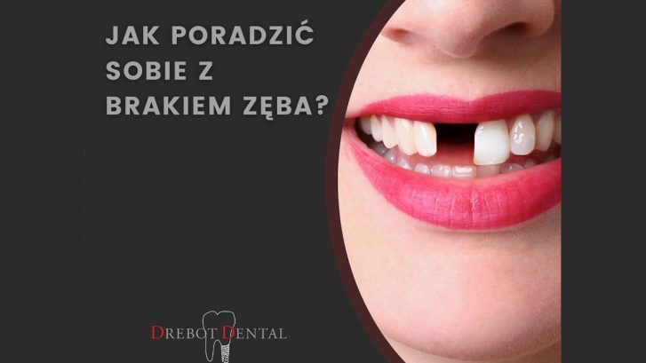 Jak poradzić sobie z brakiem zęba?