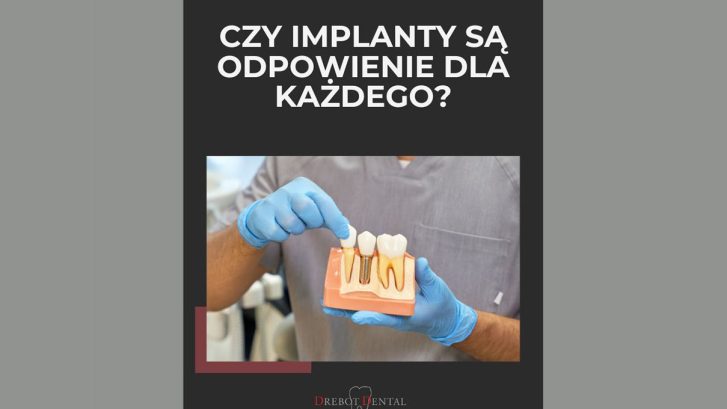 Czy implanty zębowe są dla każdego