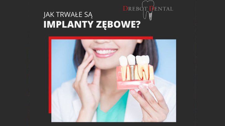 Jak Trwałe Są Implanty Zębowe?