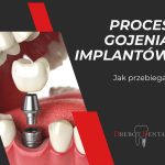 Proces gojenia implantów