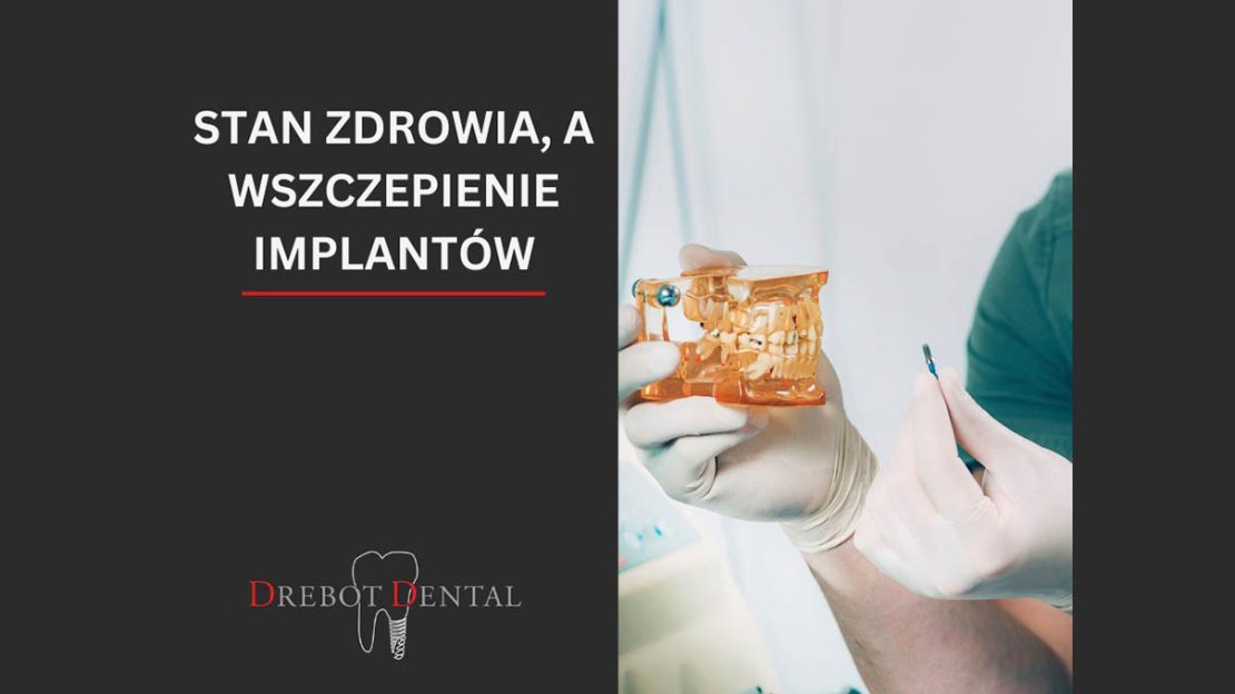 Stan zdrowia, a wszczepianie implantów