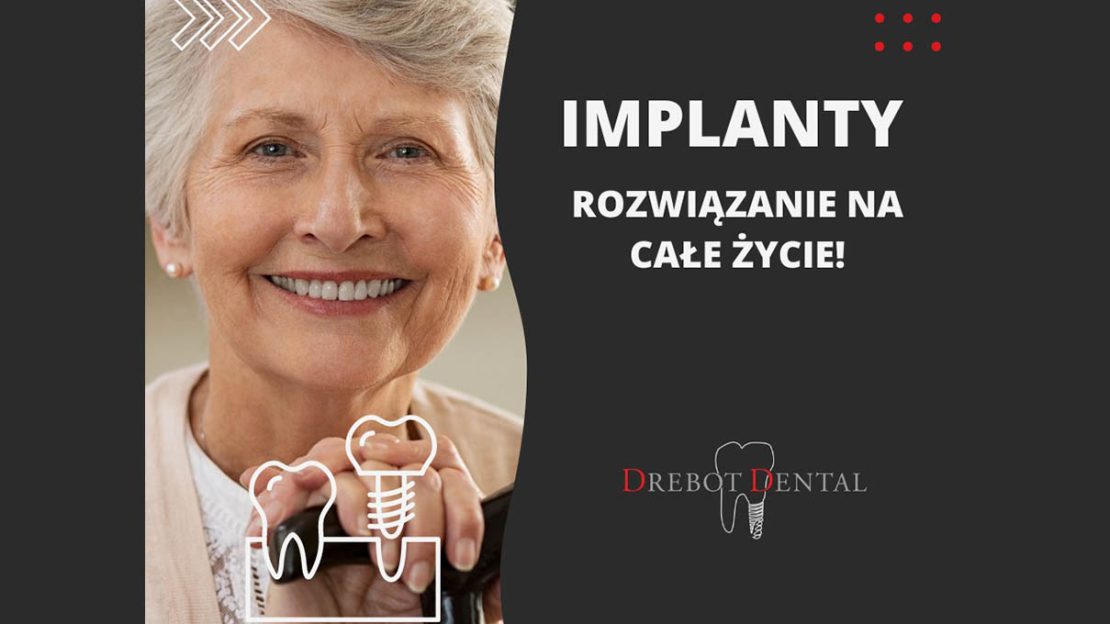 Implanty zębowe – trwałe rozwiązanie na całe życie!