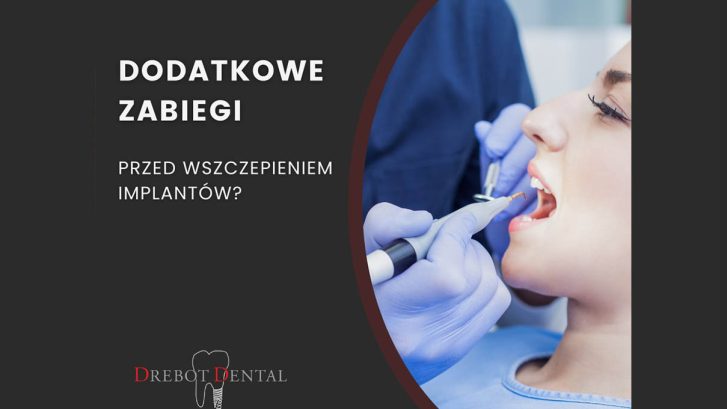 Czy potrzeba dodatkowych zabiegów przed wszczepieniem implantów