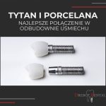 Tytan i Porcelana: najlepsze połączenie w odbudowie uśmiechu