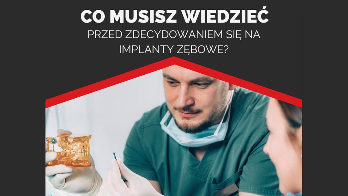 Co musisz wiedzieć przed podjęciem decyzji o implantach zębowych?