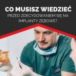 Co musisz wiedzieć przed podjęciem decyzji o implantach zębowych?