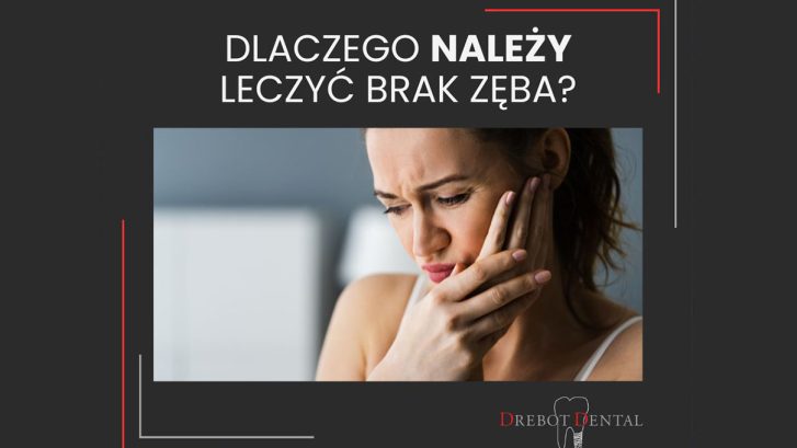 Dlaczego należy leczyć brak zęba?