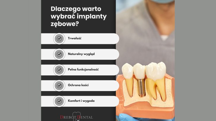 Dlaczego warto wybrać implanty zębowe?