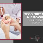 Tego nikt Ci nie powie o implantach zębowych