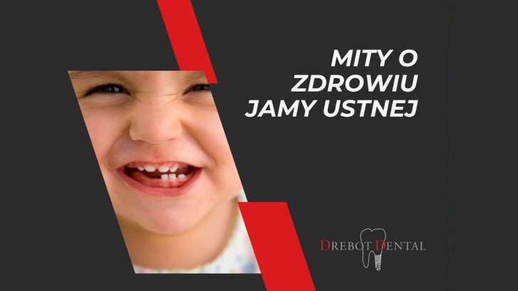 Mity o zdrowiu jamy ustnej, w które wciąż wierzymy