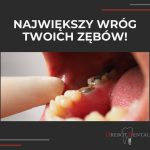 Próchnica największy wróg twoich zębów