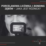 Porcelanowa licówka a bonding zębów – jaka jest różnica