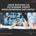 Jakie badania są potrzebne przed wszczepieniem implantu zębowego?