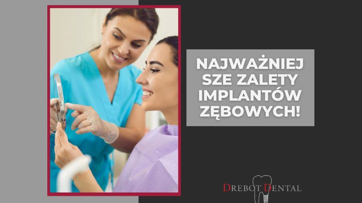 Najważniejsze zalety implantów zębowych