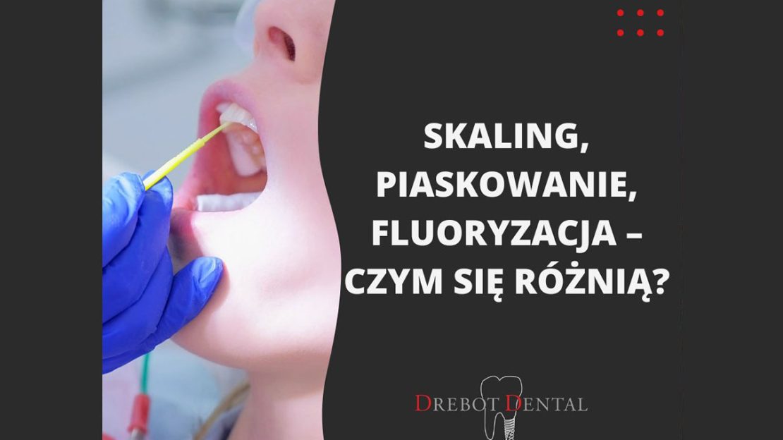 Skaling, piaskowanie, fluoryzacja – czym się różnią?