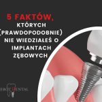 5 faktów, których nie wiedziałeś o implantach zębowych